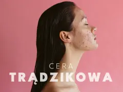 Cera trądzikowa: Jak skutecznie poprawić jej stan? Poradnik