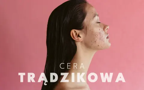 Cera trądzikowa: Jak skutecznie poprawić jej stan? Poradnik