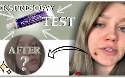 Jak długo trzymać maść ichtiolową na pryszczu? Sprawdź!