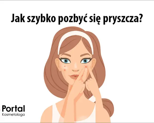 Jak szybko zmniejszyć pryszcza? Skuteczne sposoby i błędy