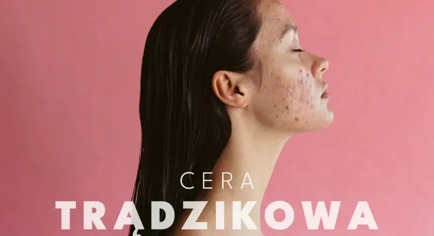 Cera trądzikowa: Jak skutecznie poprawić jej stan? Poradnik
