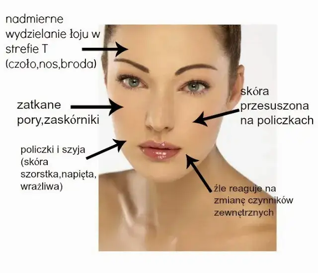 Cera mieszana strefa T i suche policzki
